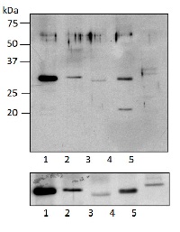 RPS5 | Ribosomal protein S5 (chloroplastic) in the group Plant/Algal Antibodies / DNA/RNA/Cell Cycle / Translation at Agrisera AB (Antibodies for research) (AS15 3075)